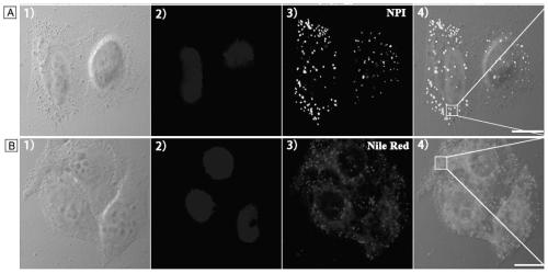 A fluorescent probe for specifically labeling lipid droplets in cells