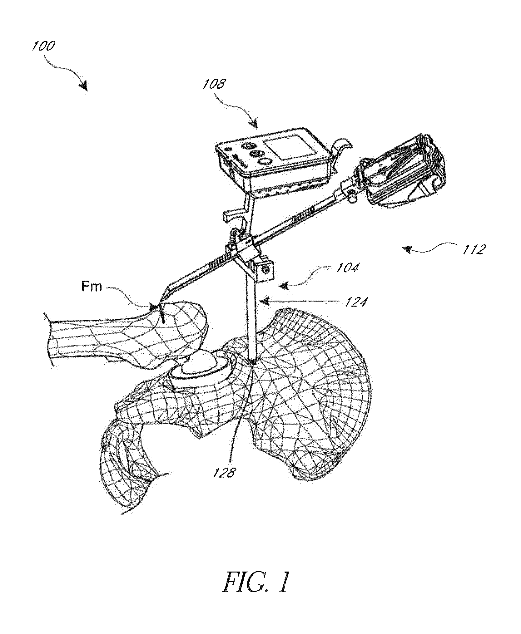 Hip replacement navigation system and method