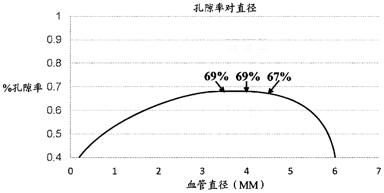 Systems and methods of using a braided implant