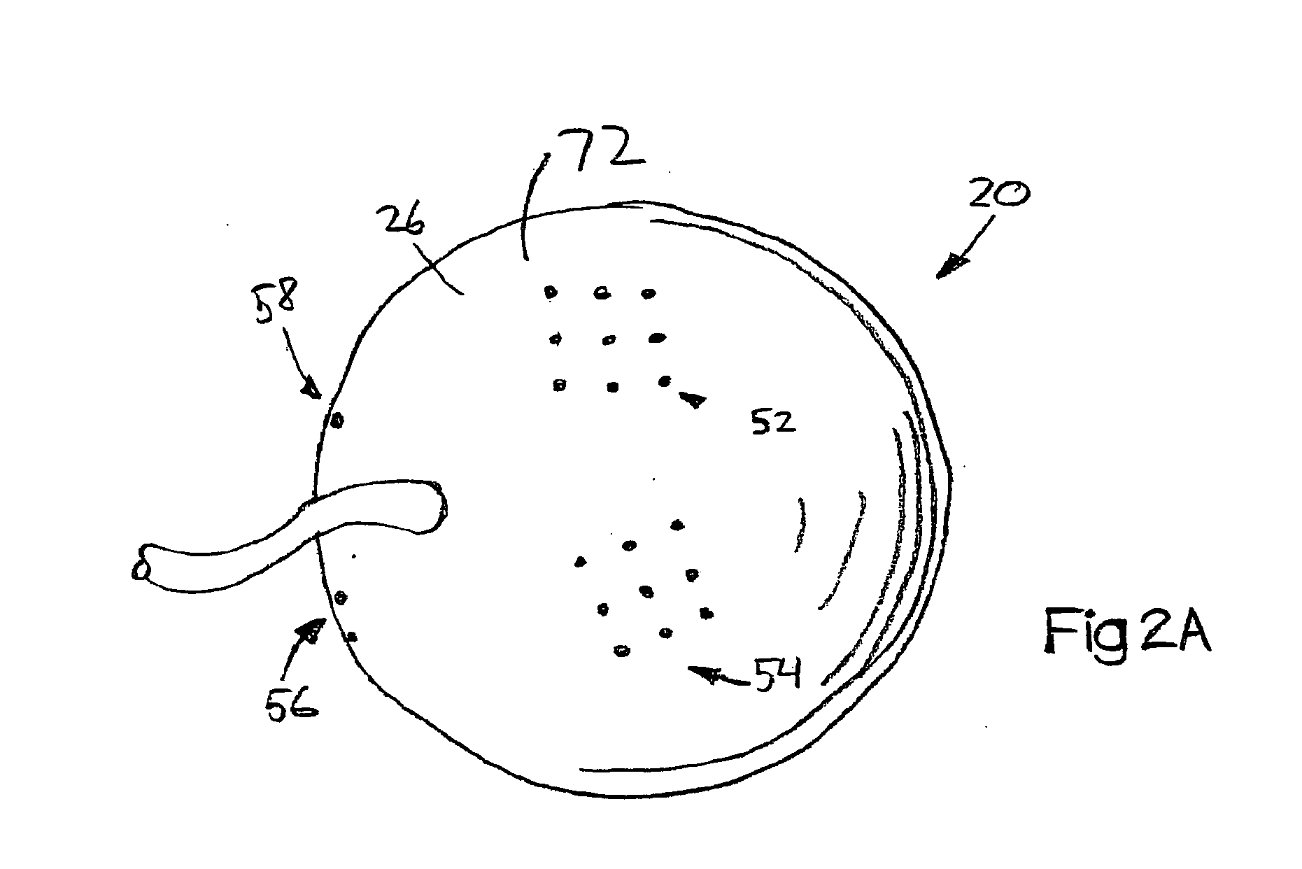 System and Method for Treating Connective Tissue