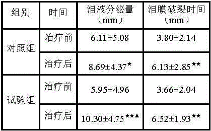 A kind of pharmaceutical composition for treating dry eye syndrome and application thereof