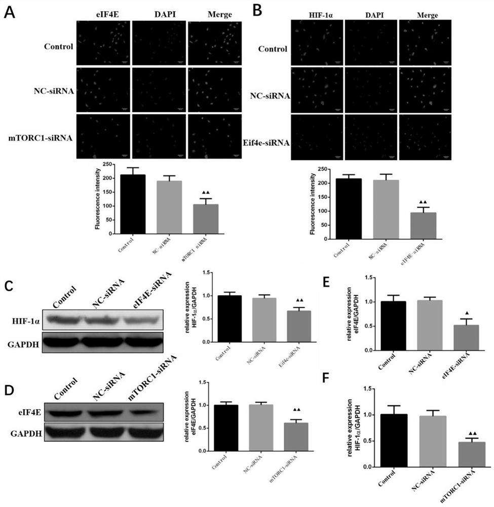 Application of borneol in preparation of brain glioma radiotherapy combined medicine