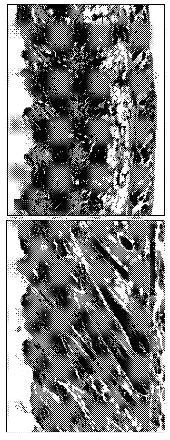 R-spondin agonist-mediated hair growth