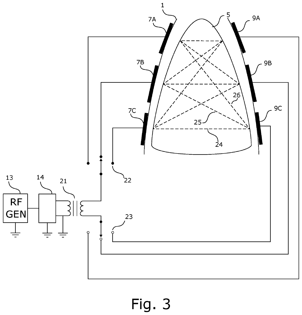 System for treating unwanted tissue using heat and heat activated drugs