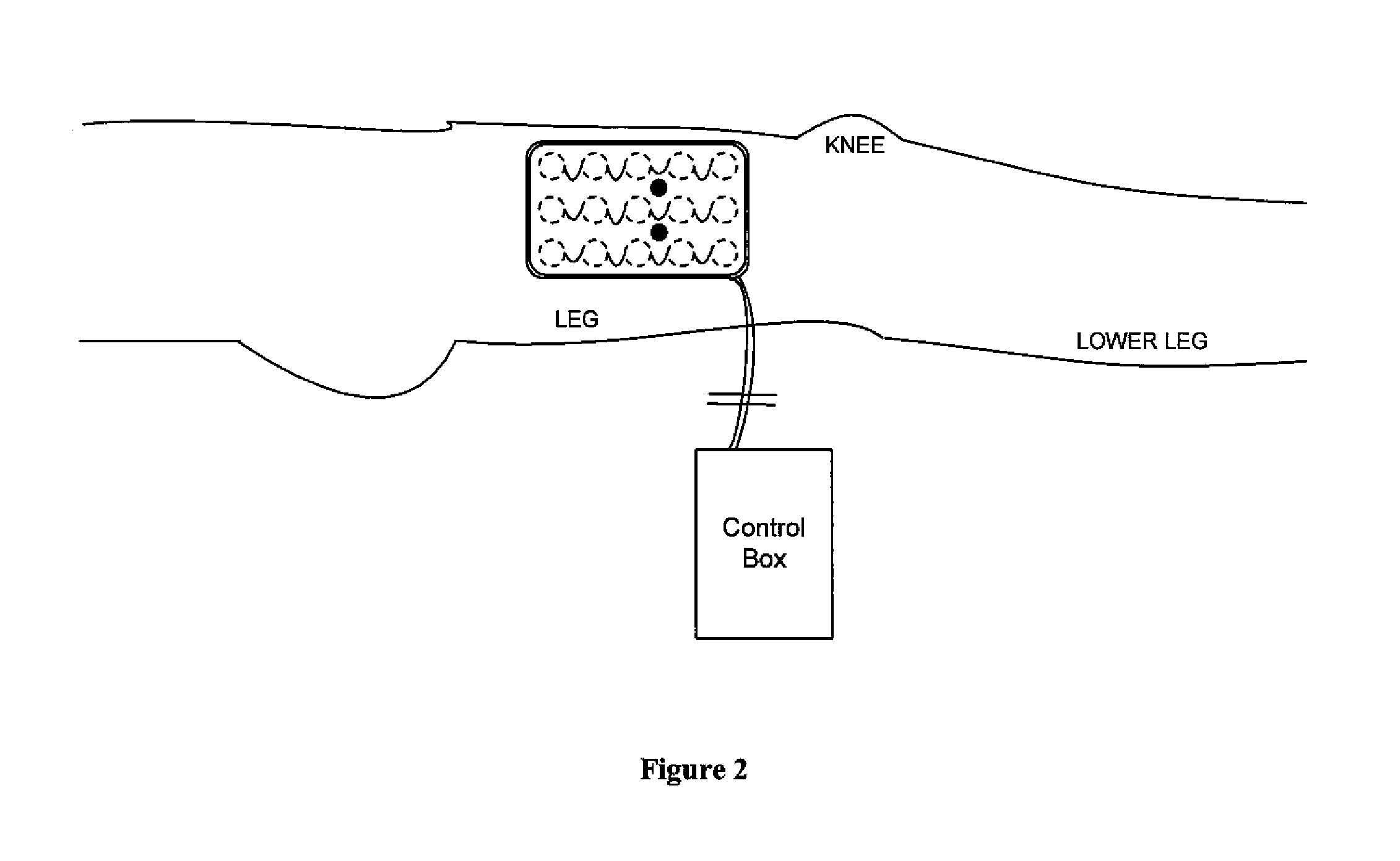 Systems and methods for automated muscle stimulation