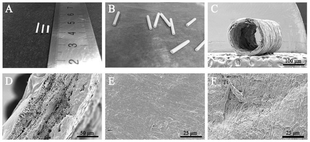 Chondroitin sulfate modified collagen/polycaprolactone vascular repair scaffold and preparation method and application thereof