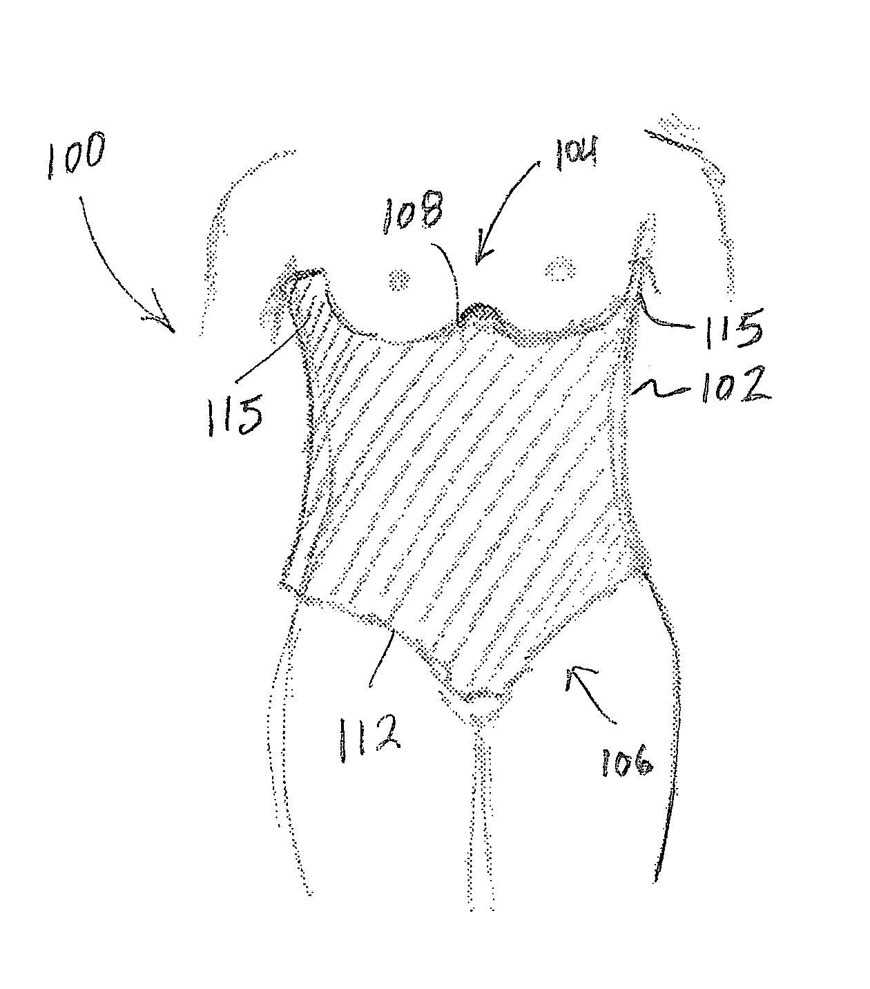 Post operative pressure garment