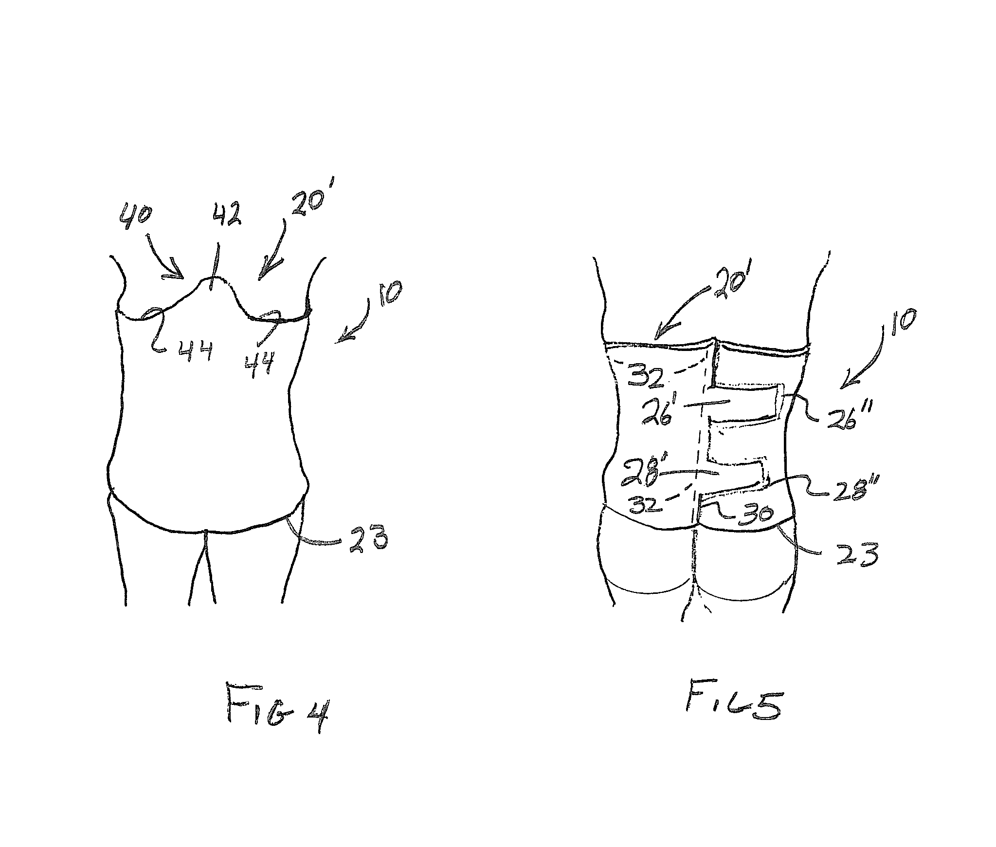 Post operative pressure garment