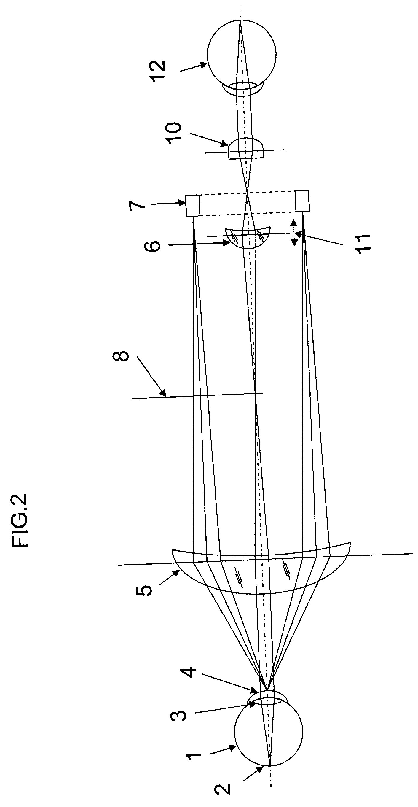 Ring light fundus camera