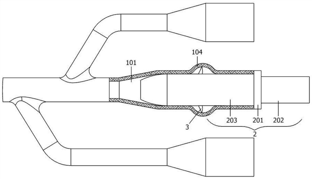 A disposable urinary catheter based on anti-reuse in urology