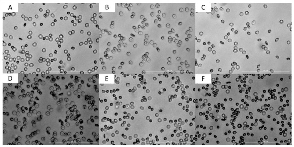 Reagent erythrocyte preservation system and preparation method thereof