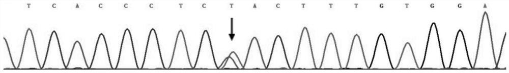 A detection kit for kcnh2 mutation gene and long qt syndrome