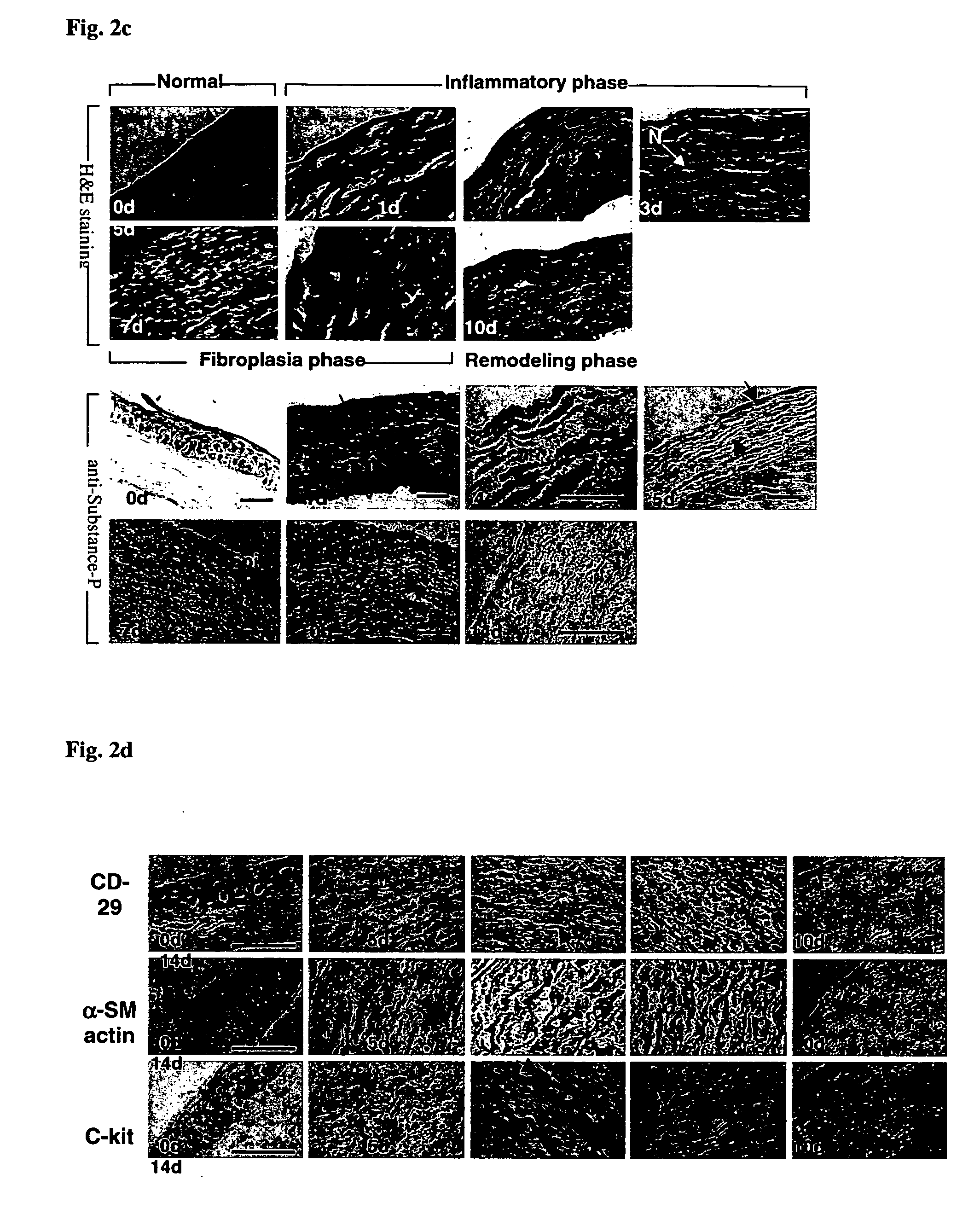 Use of substance P for mobilization of Mesenchymal stem cells or proliferation of Mesenchymal stem cells and for wound healing or facilitating wound healing