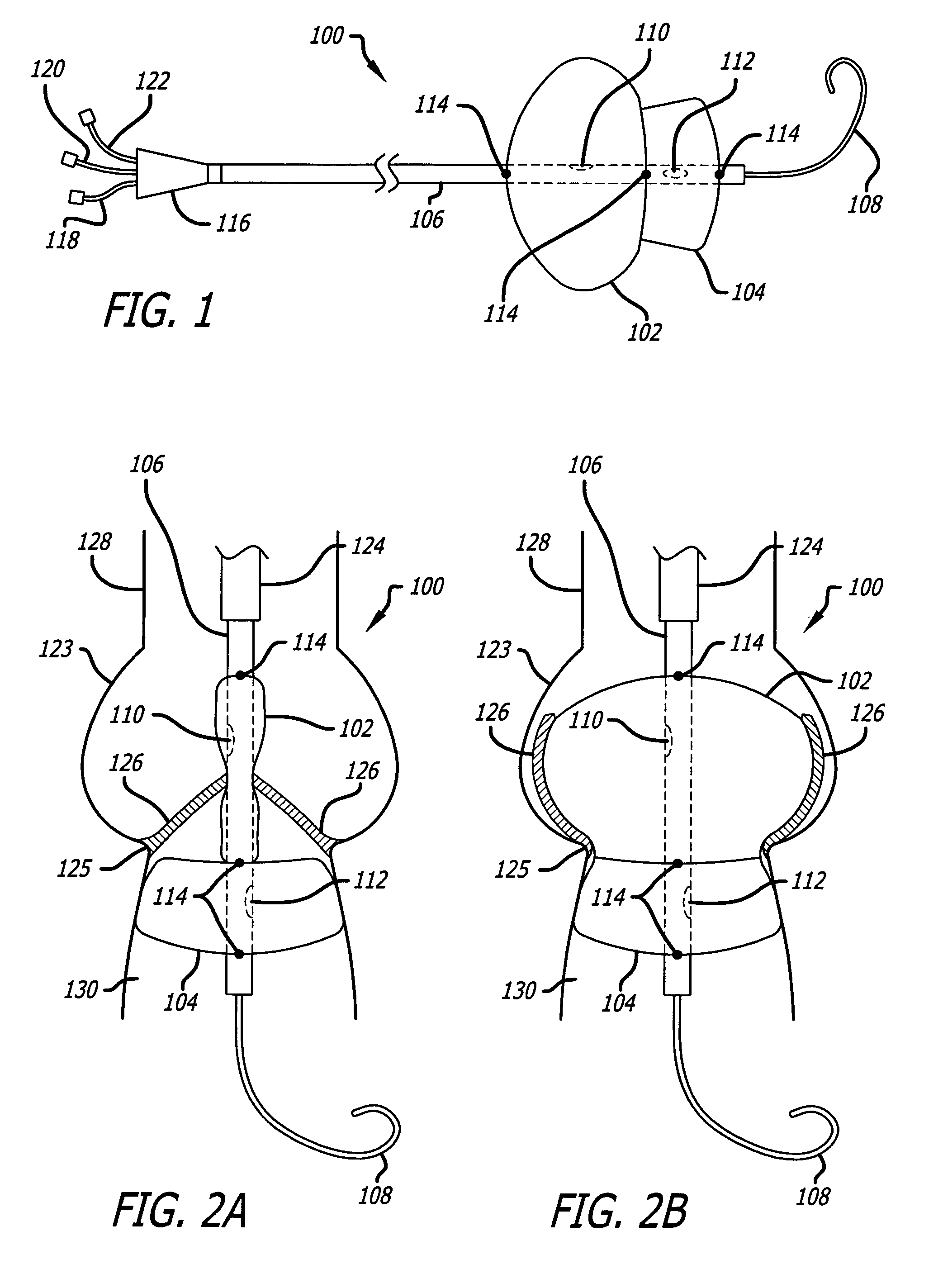 Valvuloplasty devices and methods