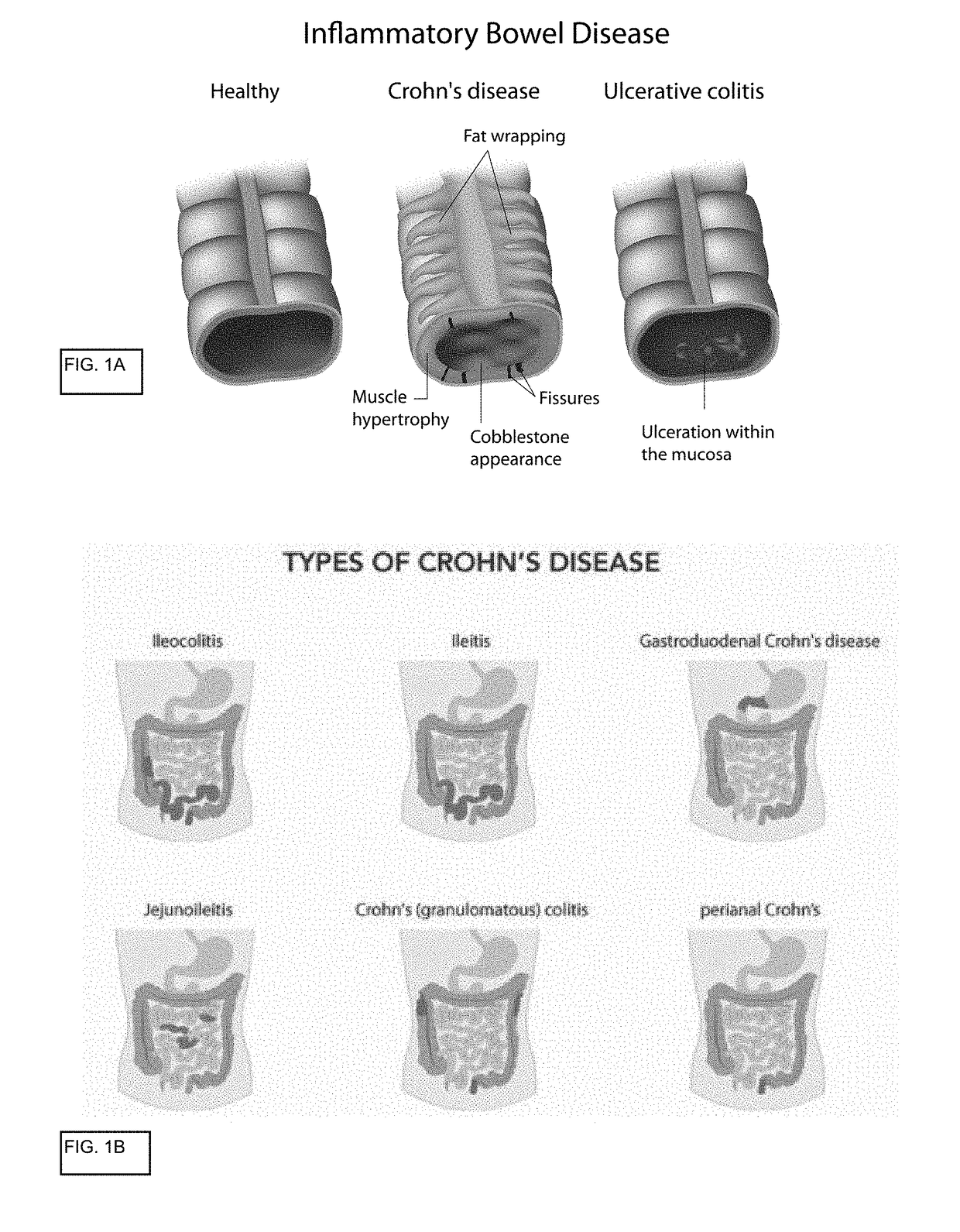 In vitro gastrointestinal model comprising lamina propria-derived cells