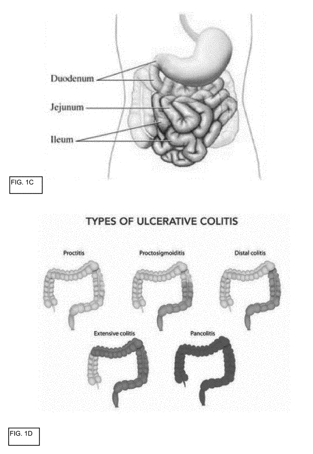 In vitro gastrointestinal model comprising lamina propria-derived cells