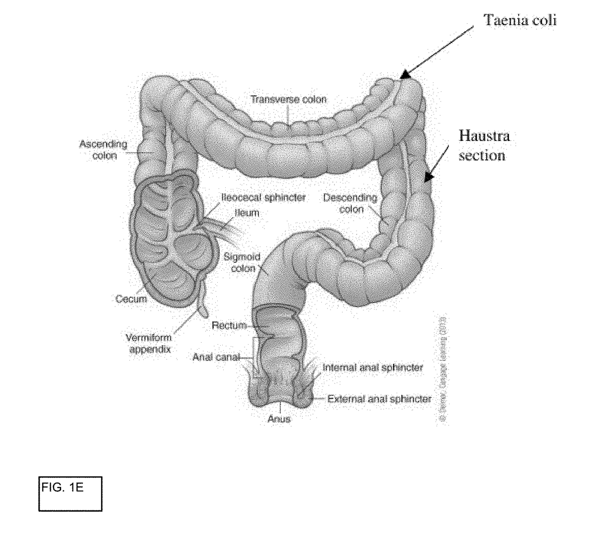 In vitro gastrointestinal model comprising lamina propria-derived cells