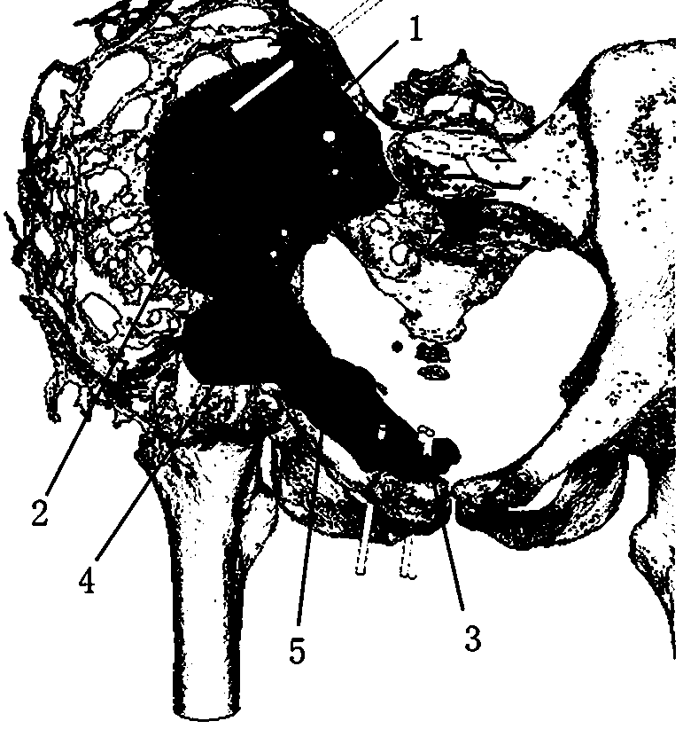 Multifunctional 3D printing internal fixation plate used for pelvic bone repair and preparation method thereof