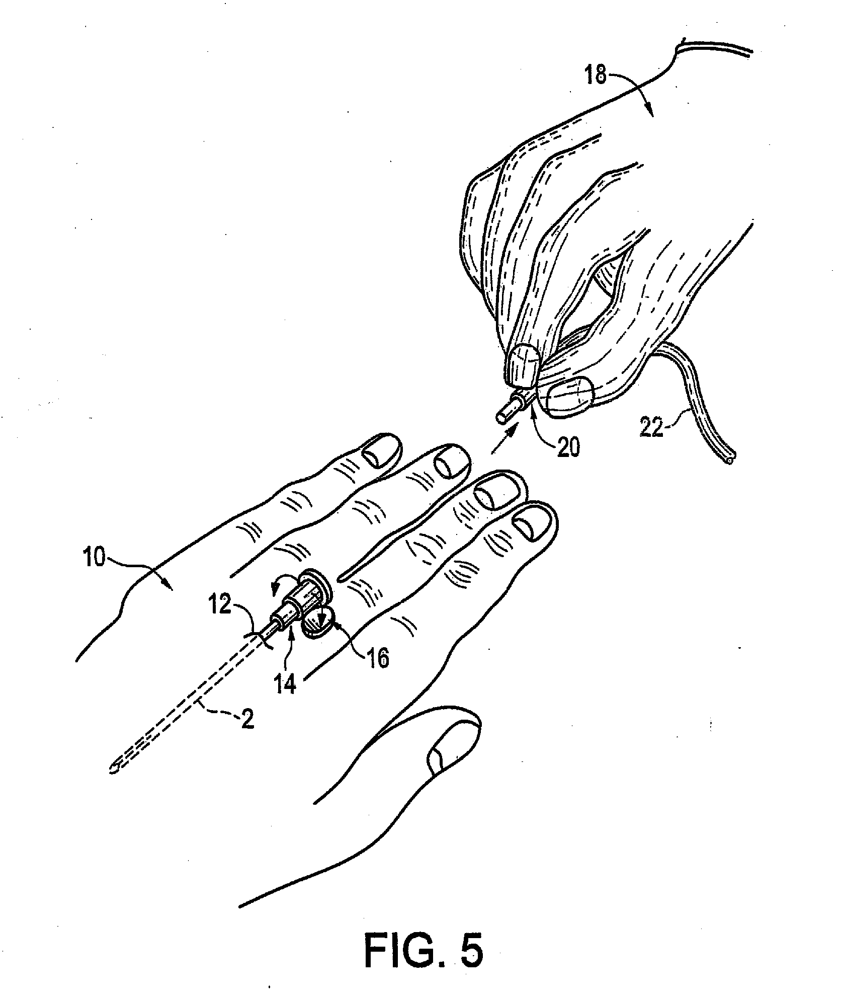 Catheter