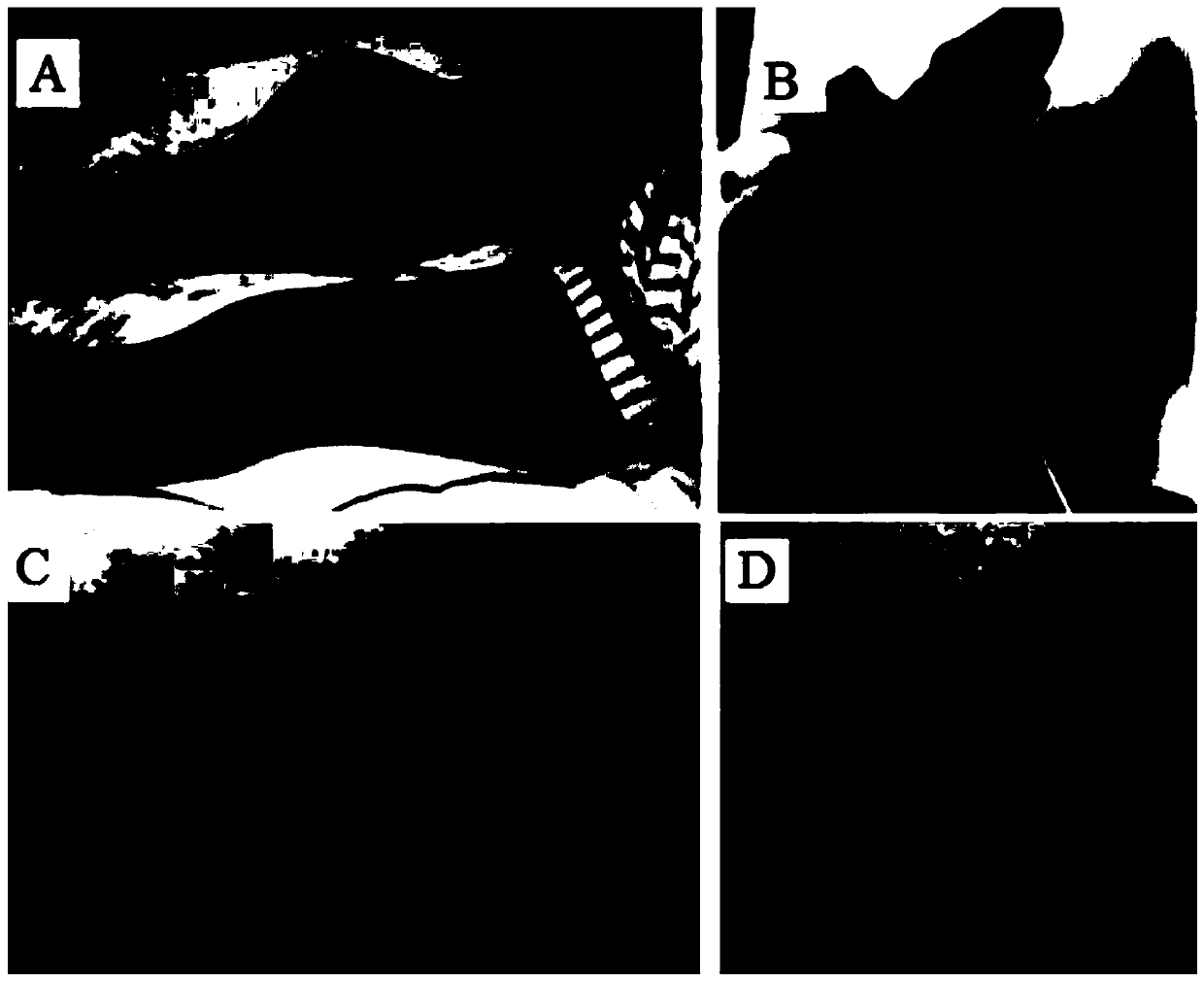 Construction method of synovial sarcoma xenograft mouse model