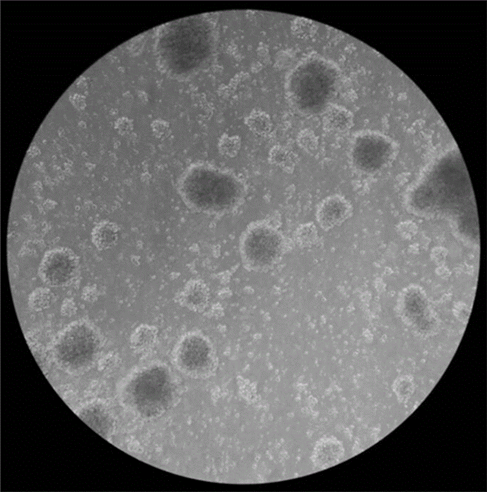 Efficient CIK cell culturing method