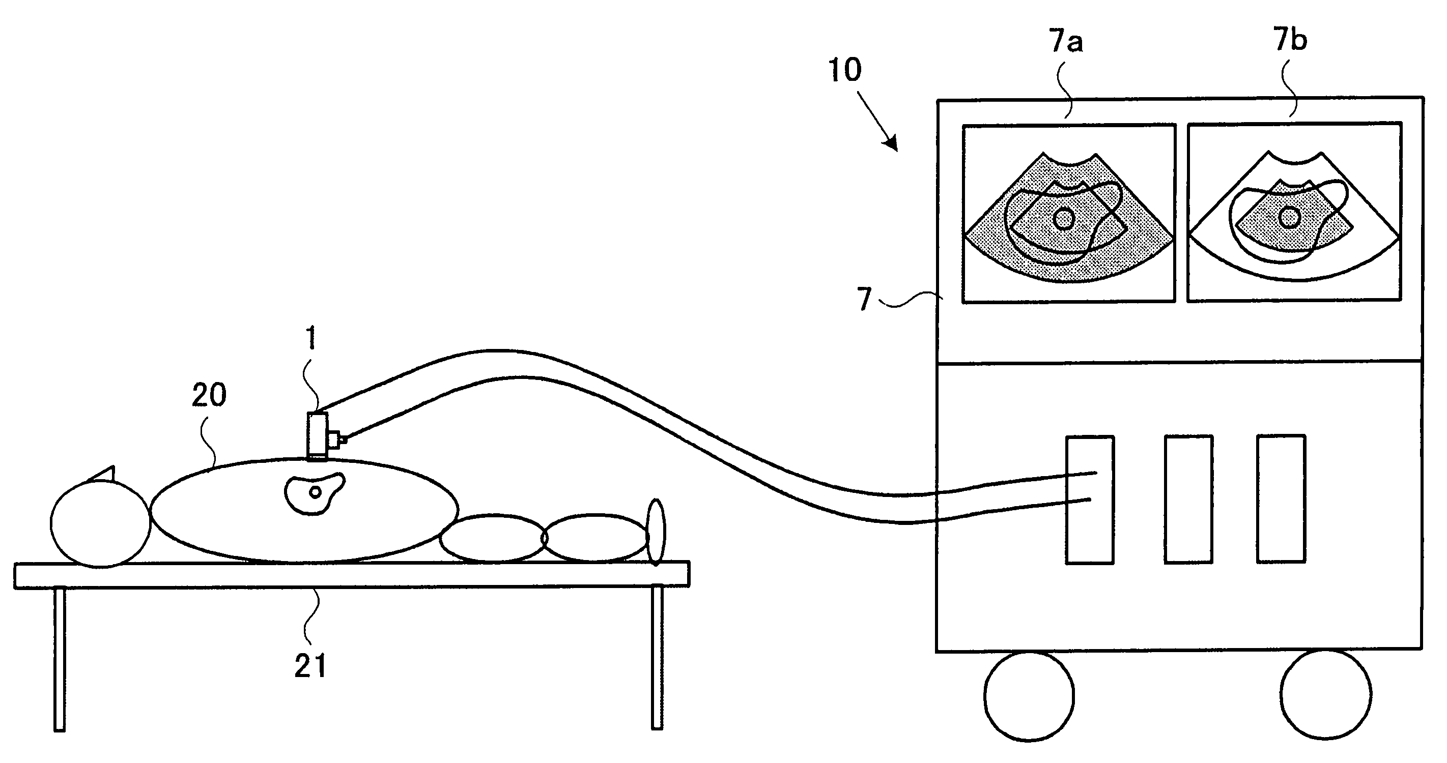 Biological tissue elasticity measurement method and ultrasonographic device