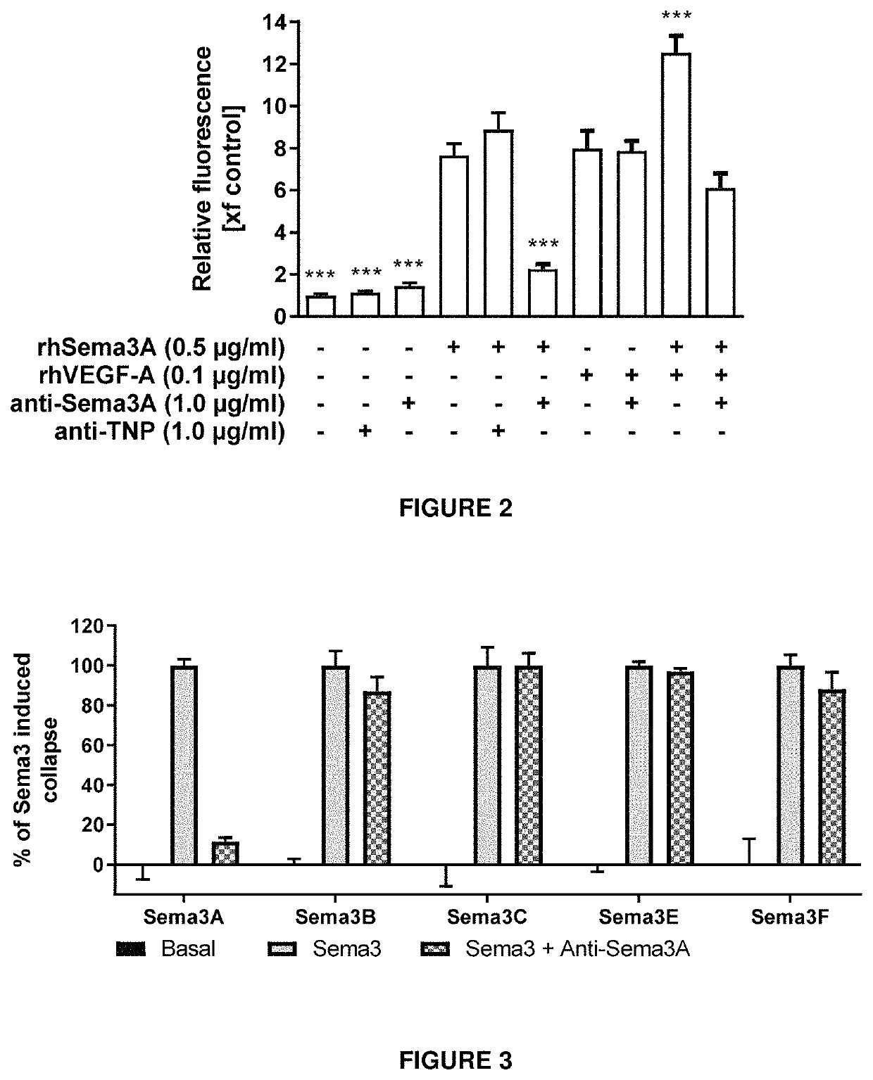 Anti-Sema3A antibodies and their uses for treating eye or ocular diseases