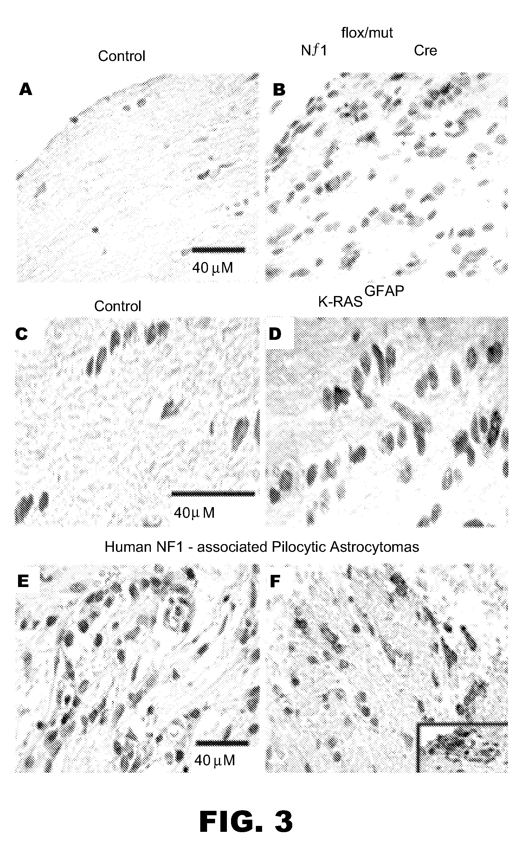 Neurofibromin pathway modulators