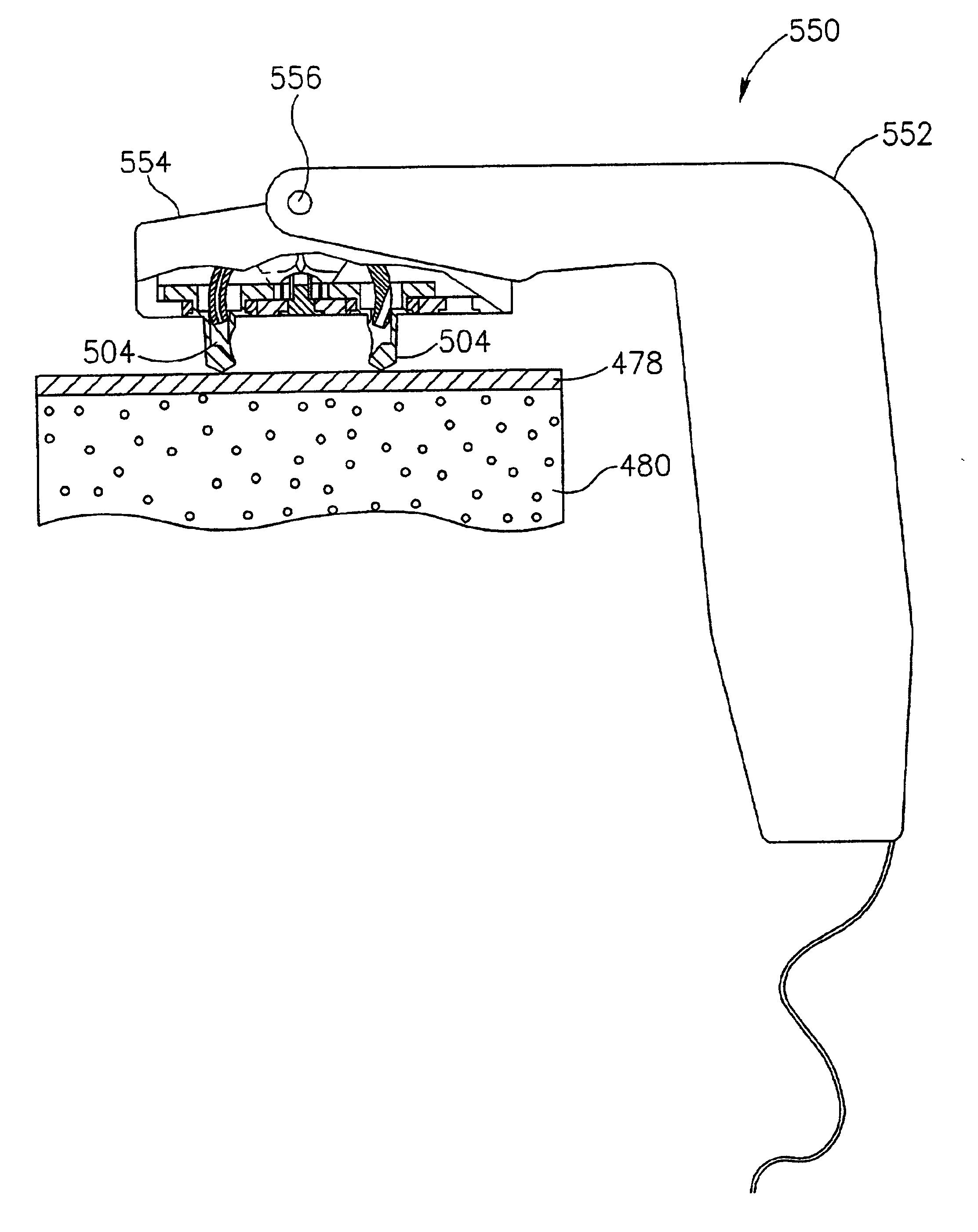 Bone suturing device