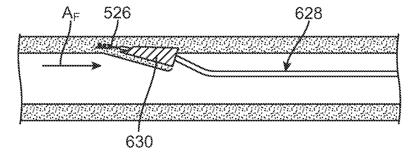 Percutanous Methods for Creating Native Tissue Venous Valves