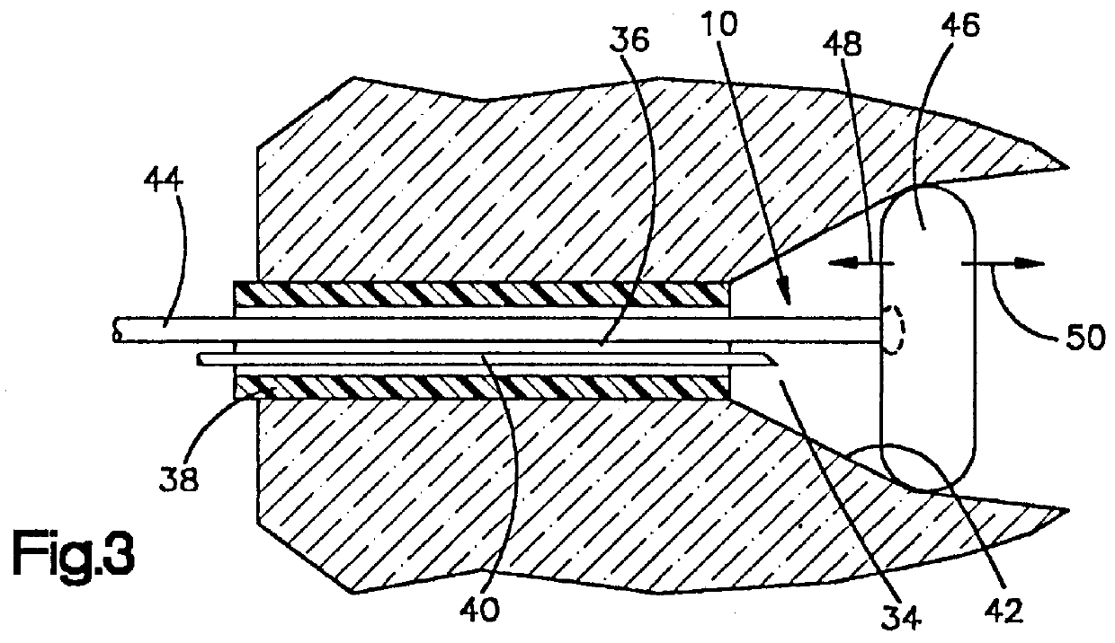 Method of retracting bones