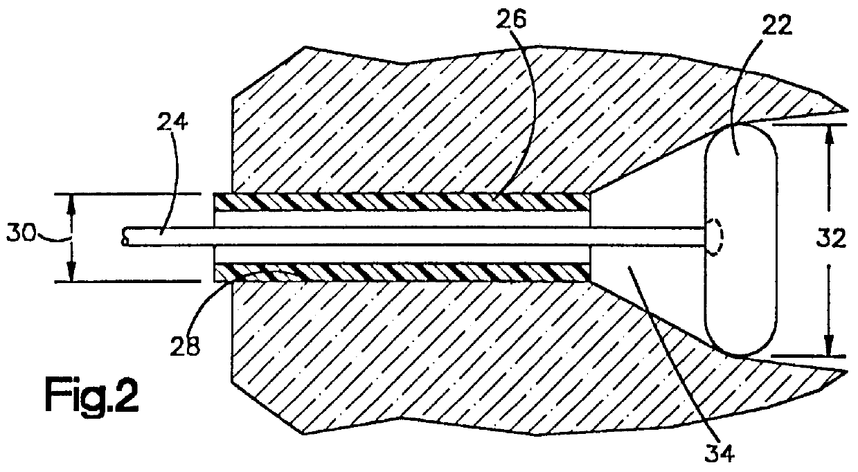 Method of retracting bones