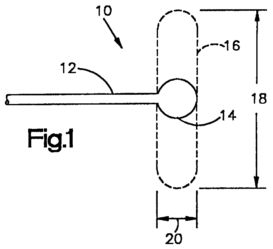 Method of retracting bones