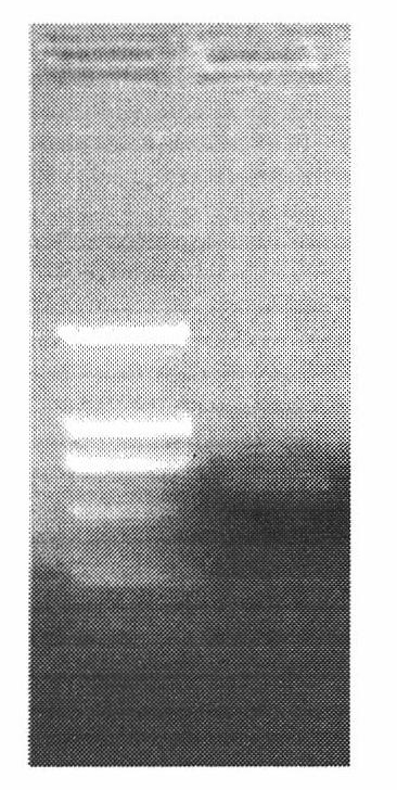 Construction and application of porcine circovirus type II-porcine mycoplasma pneumoniae expressing strains