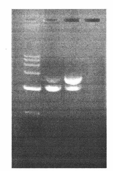 Construction and application of porcine circovirus type II-porcine mycoplasma pneumoniae expressing strains