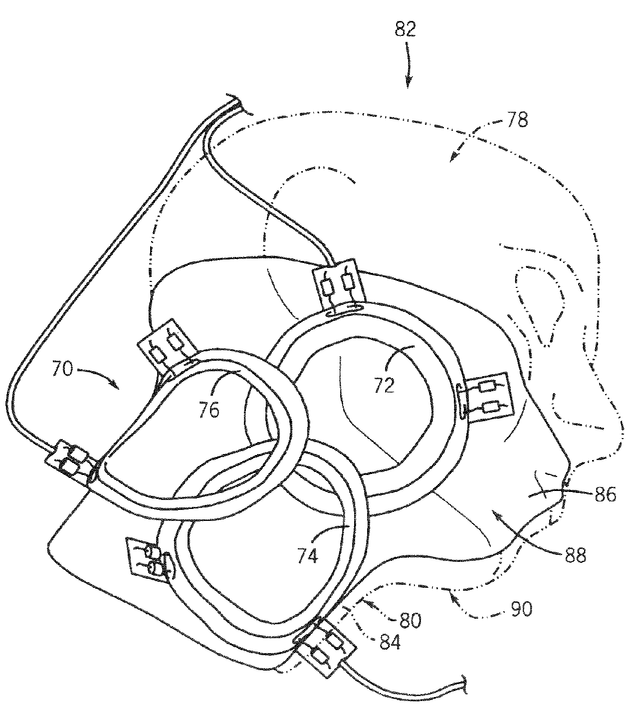 6-channel array coil for magnetic resonance imaging