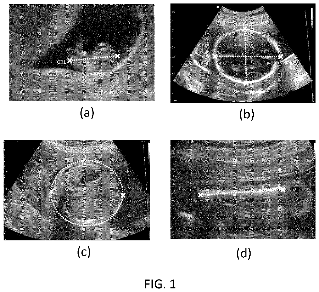 Device and method for obtaining anatomical measurements from an ultrasound image