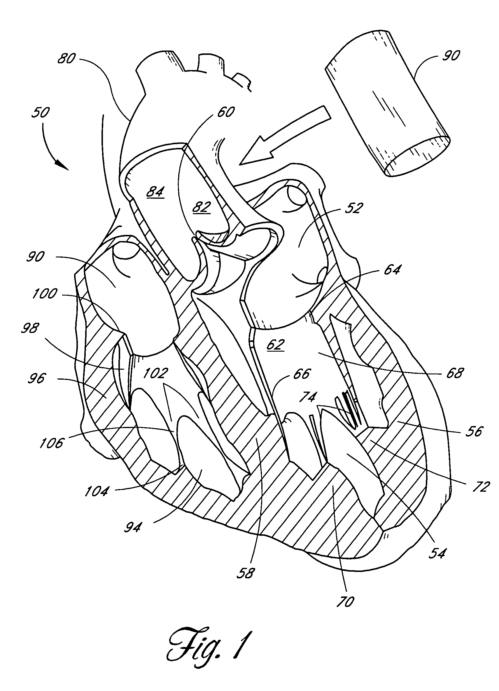 Prosthetic heart valve