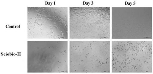 Application of self-assembling oligopeptide to rapid repair of skin tissue trauma