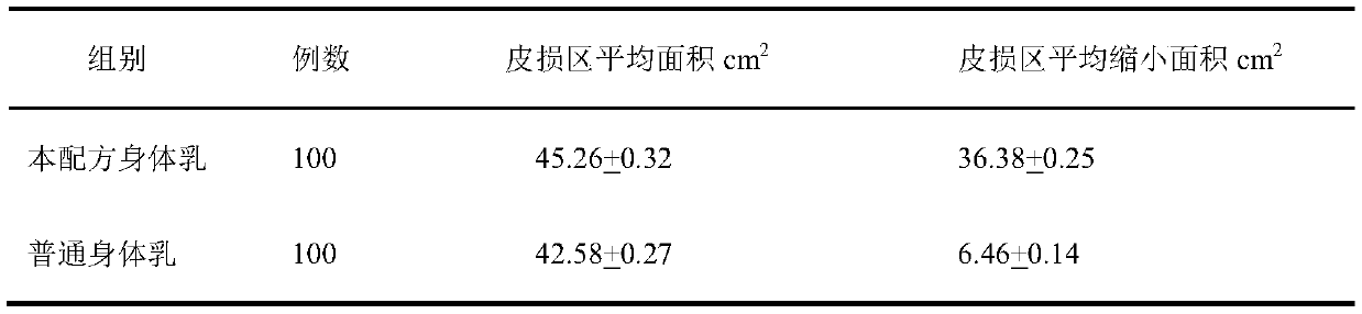 Formula of body lotion for routine maintenance of psoriasis skin