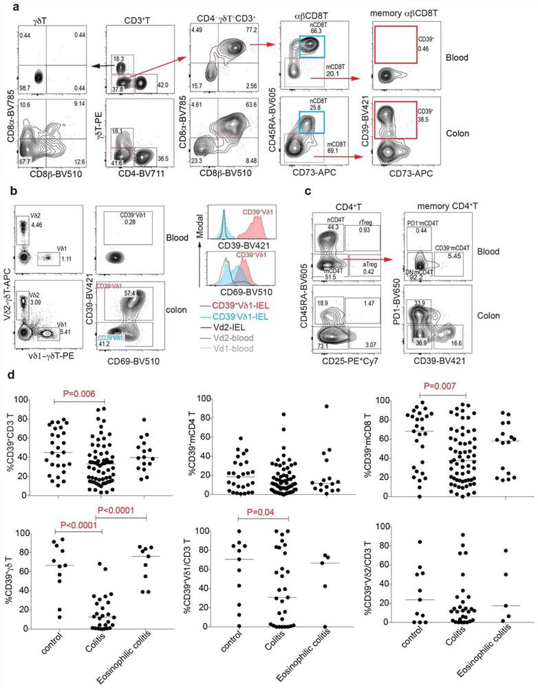 Immune mechanism and therapeutic drug for gastrointestinal diseases