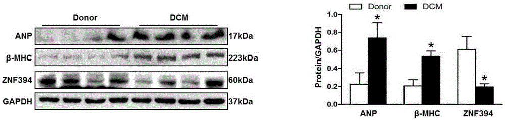 Application of zinc finger protein 394 (ZNF394) in treating myocardial hypertrophy