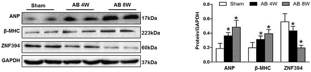 Application of zinc finger protein 394 (ZNF394) in treating myocardial hypertrophy