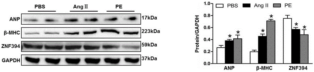 Application of zinc finger protein 394 (ZNF394) in treating myocardial hypertrophy