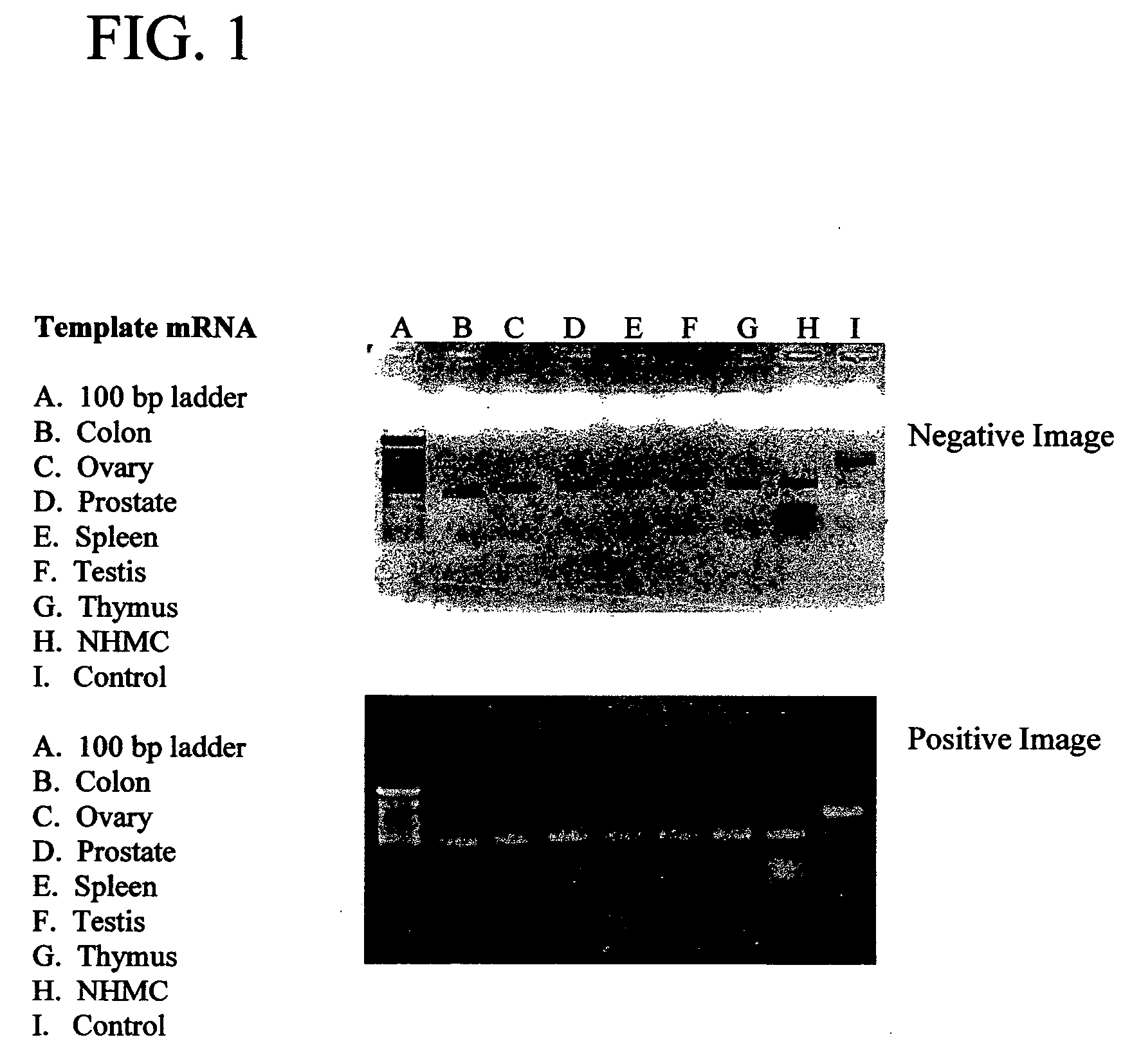 Epithelial cell growth inhibitors