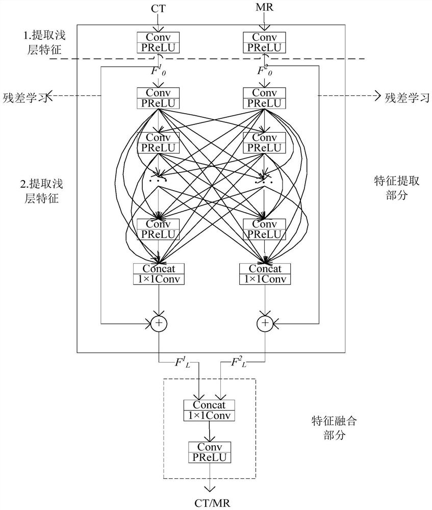 Multi-modal medical image fusion method based on double-residual ultra-dense network