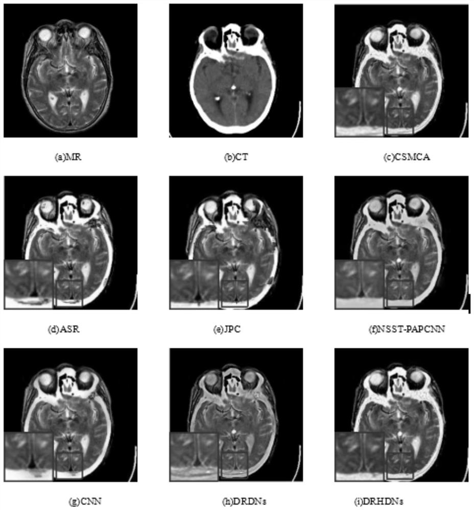 Multi-modal medical image fusion method based on double-residual ultra-dense network