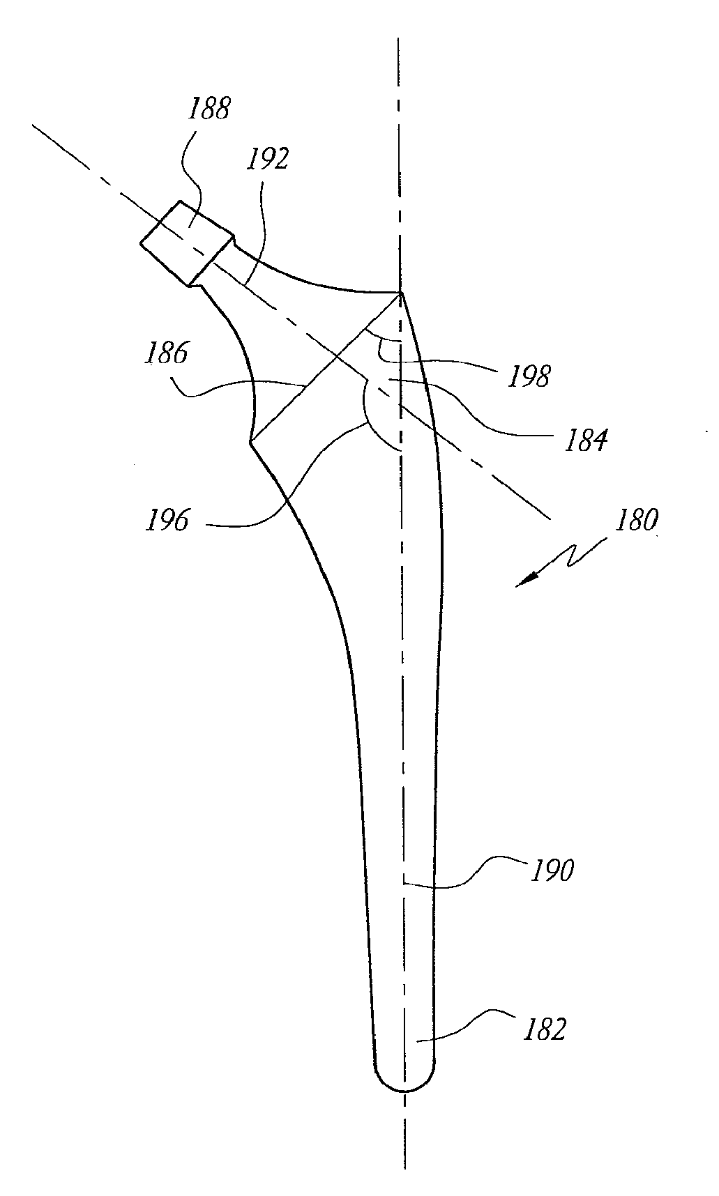 Femoral and humeral stem geometry and implantation method for orthopedic joint reconstruction