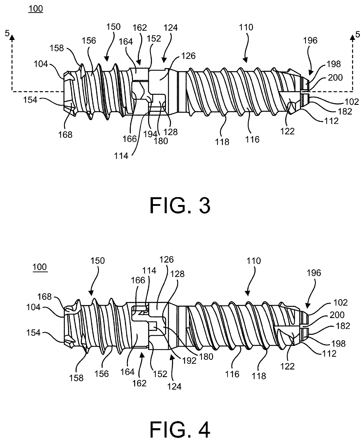 Implants and methods of use and assembly