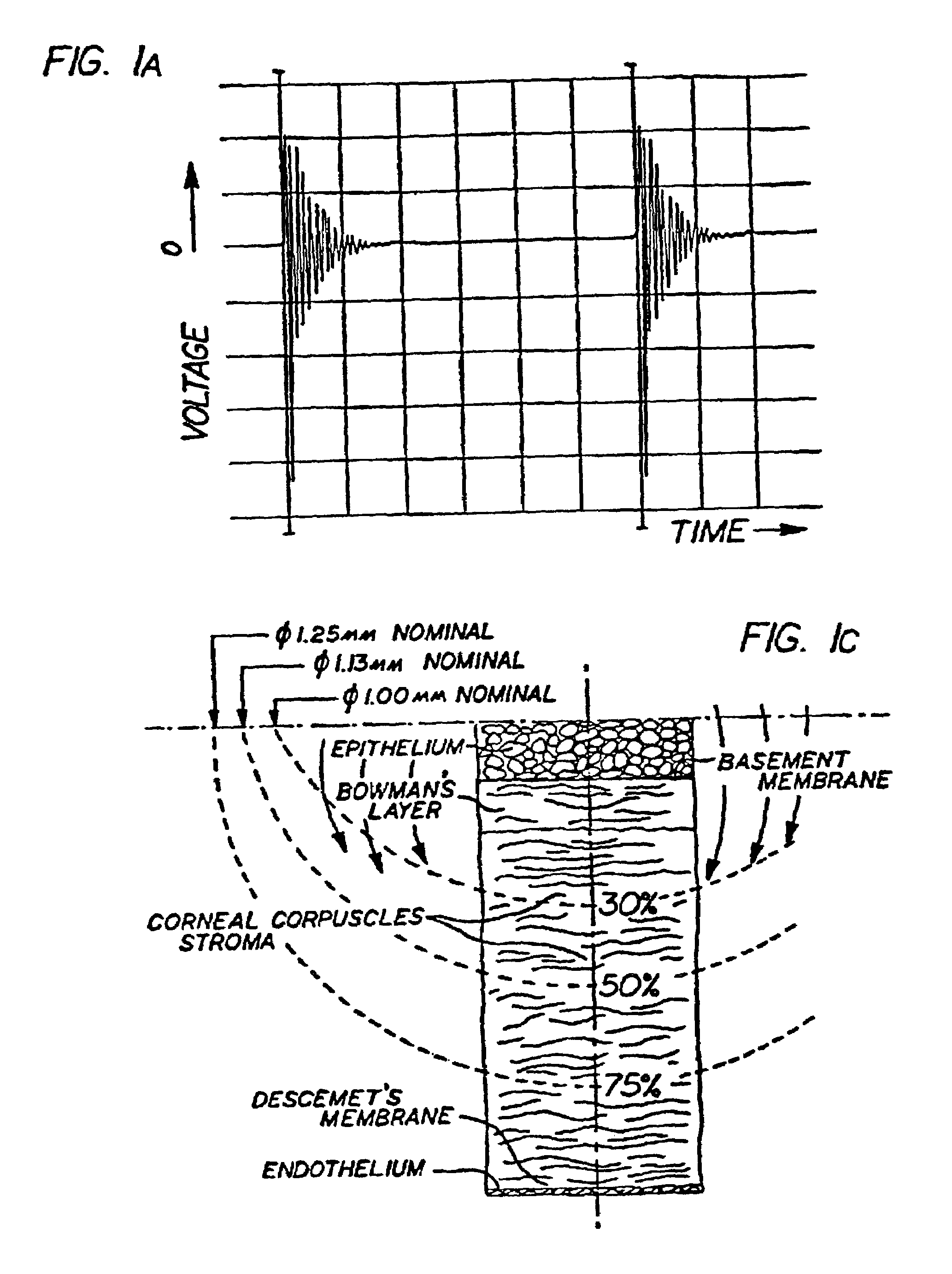 Method and apparatus for modifications of visual acuity by thermal means